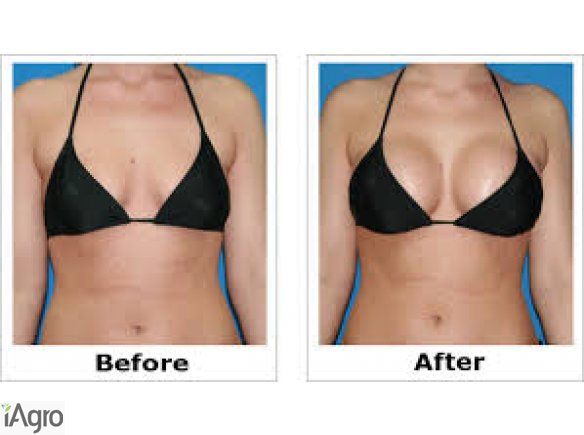 BREAST ENLARGEMENT OR ENHANCEMENT +27605775963 CREAM AND PILLS