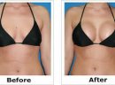 BREAST ENLARGEMENT OR ENHANCEMENT +27605775963 CREAM AND PILLS